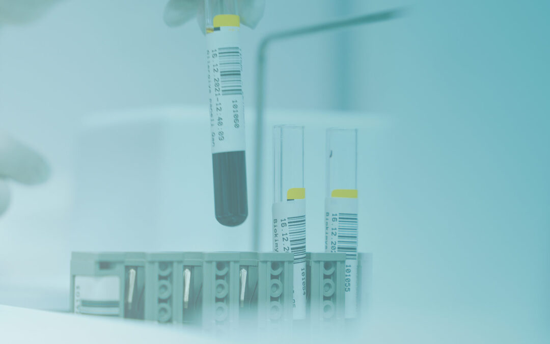 Chronische Kieferostitis erkennen – mit Rantes-Diagnostik?